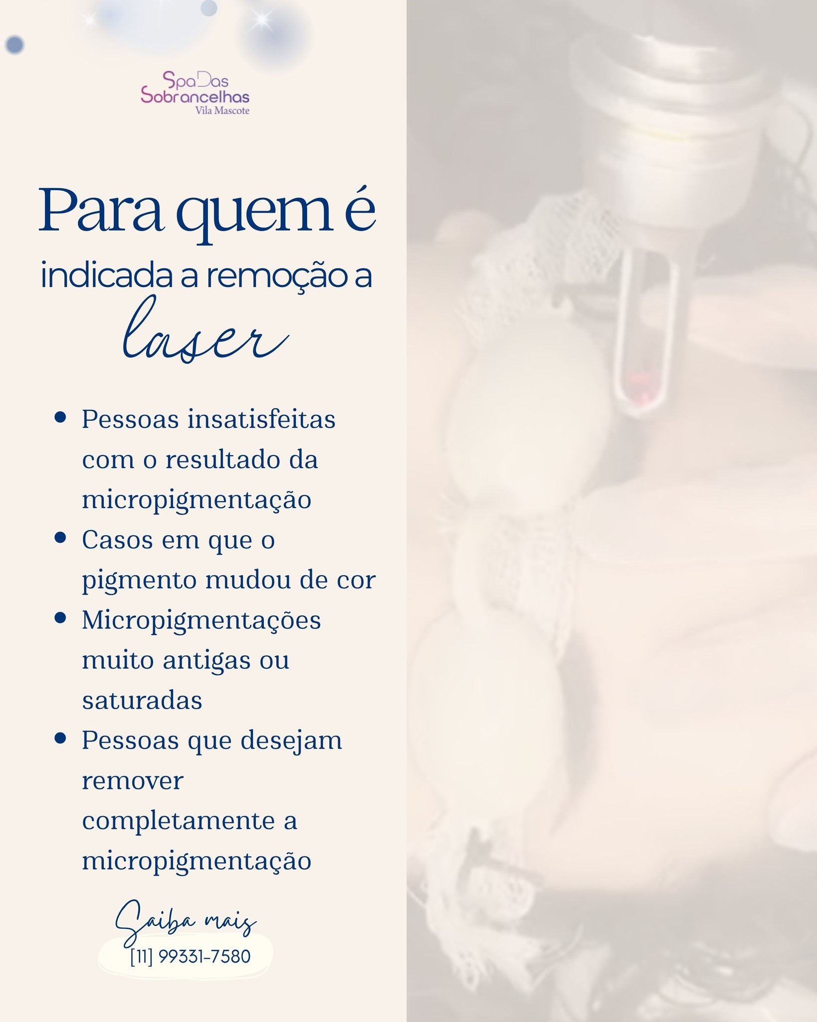 Você não precisa conviver com uma micropigmentação que não te representa mais.
Hoje teremos o nosso Laser Day no Spa das Sobrancelhas Vila Mascote — um dia dedicado exclusivamente à remoção a laser com segurança e resultados reais.

Aproveite as condições especiais:
▪️Despigmentação de sobrancelhas e pequenas tatuagens (280,00 por sessão);

Quer garantir o seu horário? Entre em contato com a gente! 💜✨

#laserday #RemocaoDeMicropigmentacao #remocaodetatuagem #spavilamascote